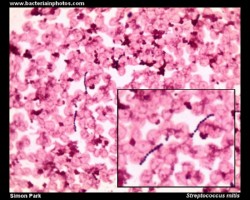 streptococcus mitis